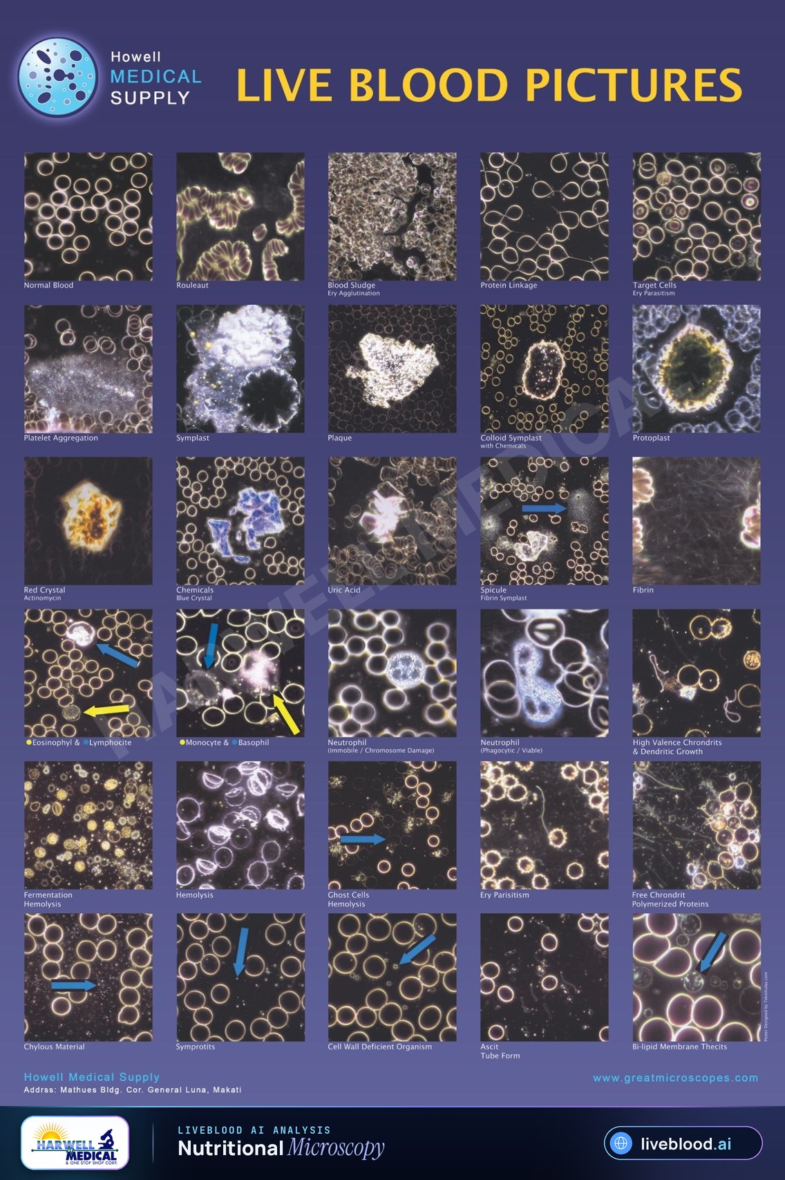 Howell Medical Supply live blood microscopy poster showing red blood cell arrangements, white blood cells, platelet aggregation, fibrin-like strands, crystals, hemolysis-like changes, and other historically labeled blood patterns.